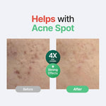 Carregar imagem no visualizador da galeria, PURITO – Wonder Releaf Centella Serum Unscented, 60ml